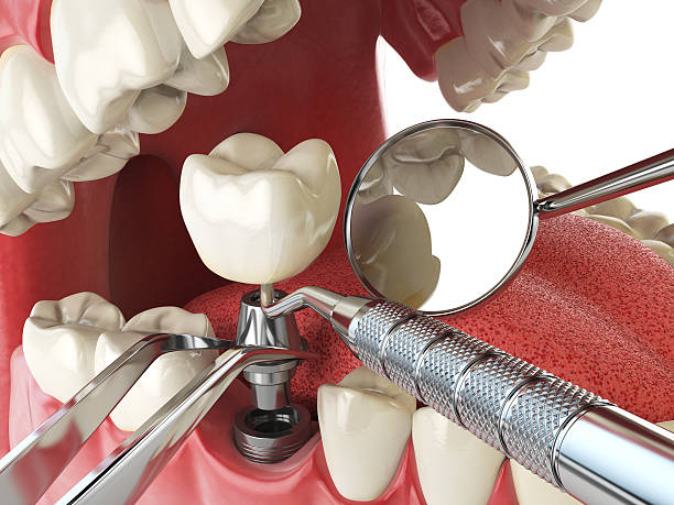 Best Knocked-Out Tooth Emergency  in South Berwick, ME